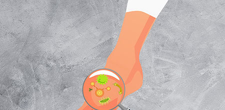 Dolor en los pies debido a la obesidad infantil El dolor en los pies dificulta comenzar a realizar actividad física